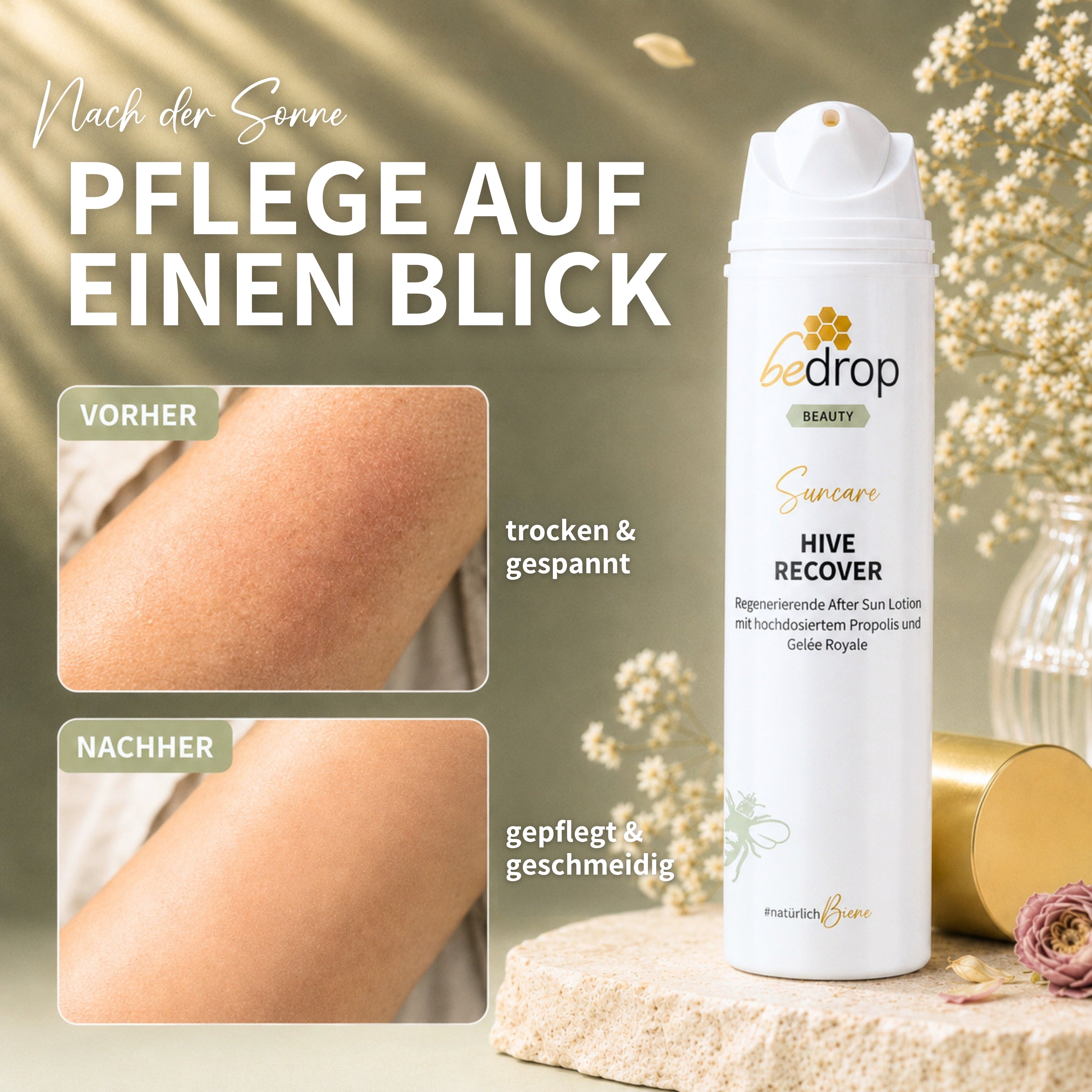 Vorteilsset: 6x HIVE RECOVER - regenerierende After Sun Lotion mit hochdosiertem Gelée Royale & Propolis - 200ml